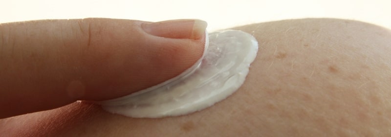 woman applying cortisone cream to skin which can cause red skin syndrome 